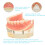 Dental Teaching Model Lower Jaw Overdenture with 4 Implants for Hygiene Training and Demonstration 2