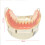 Dental Teaching Model Lower Jaw Overdenture with 4 Implants for Hygiene Training and Demonstration 5