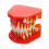 Dental Implant Model with Removable Teeth and Visible Interface for Kids and Adults Study Training 2