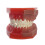 Dental Implant Model with Removable Teeth and Visible Interface for Kids and Adults Study Training 3