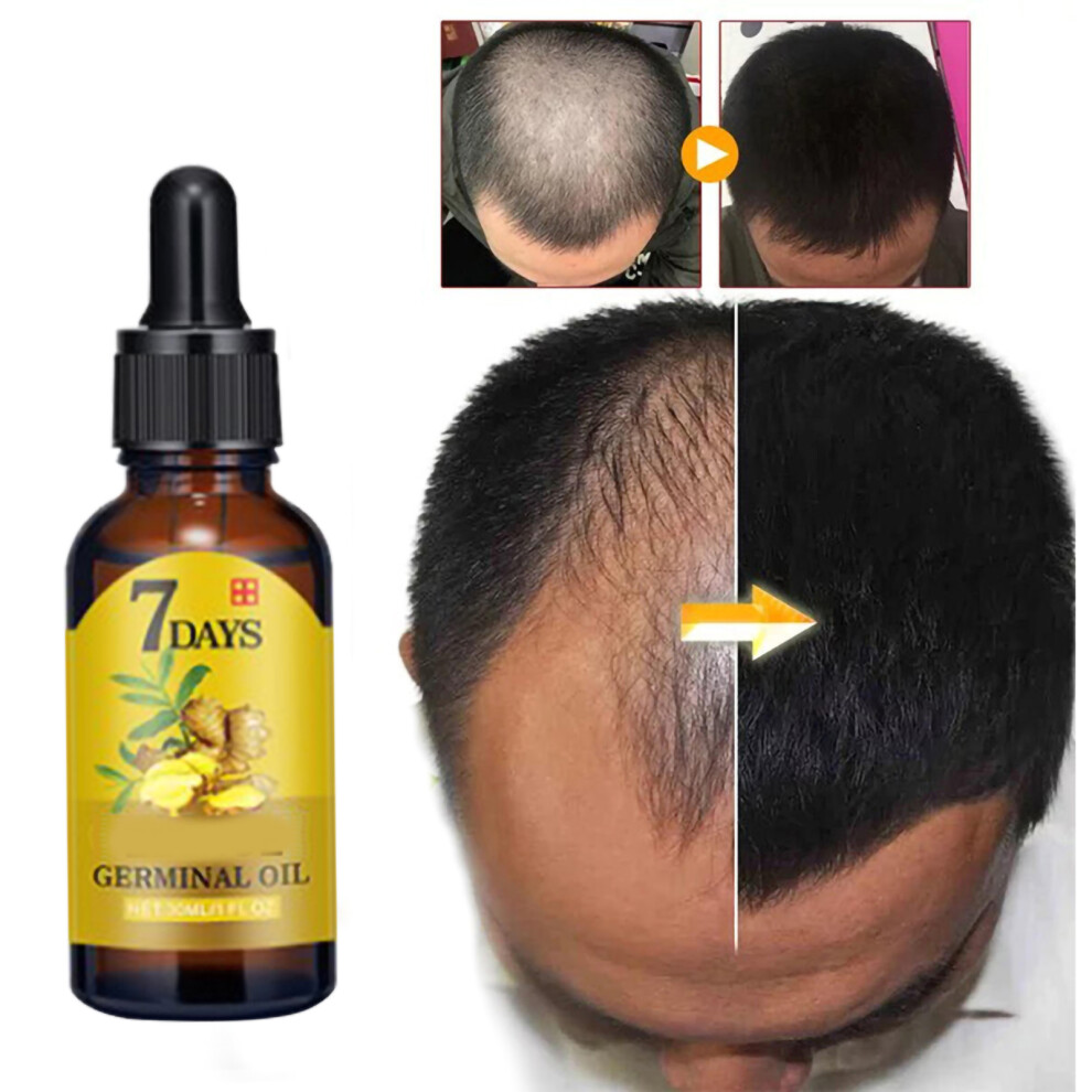 40ml Ginger Hair Growth Oil Serum for Nourishment & Anti Hair Loss