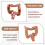 Teaching Model,Human Large Intestine Anatomy Model Visceral Lesion Model Human Digestive System Learning Model 3