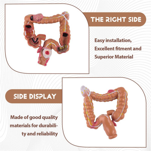 Teaching Model,Human Large Intestine Anatomy Model Visceral Lesion Model Human Digestive System Learning Model 2