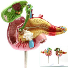 Anatomical Model Pancreas Duodenum Spleen with Pathology Visualization for Medical Anatomy Teaching