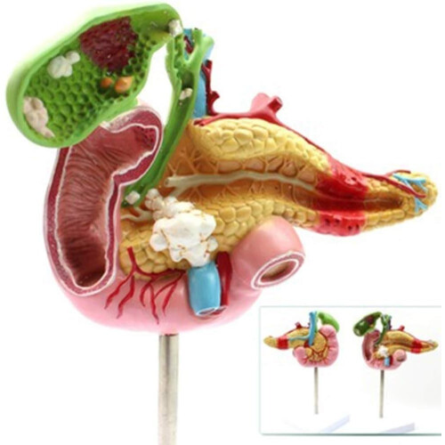 Anatomical Model Pancreas Duodenum Spleen with Pathology Visualization for Medical Anatomy Teaching