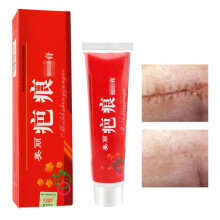 60 g Aknenarbenentferner Creme, Narbenaufheller, Schnell antipruritisch, Narbenentferner
