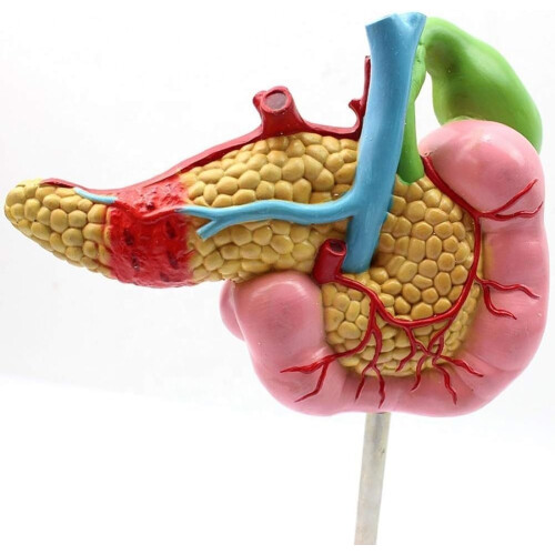 Anatomical Model Pancreas Duodenum Spleen with Pathology Visualization for Medical Anatomy Teaching 1