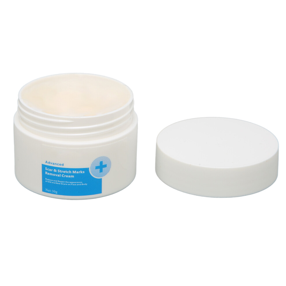 Cream Stretch Marks Removal 30G Evening Skin Tone Fade & Smoothingmassage