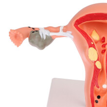 Female Uterine Model, Anatomy of Reproductive Organ Structure, Human Teaching Pathology, Ovarian Hospital, School Use