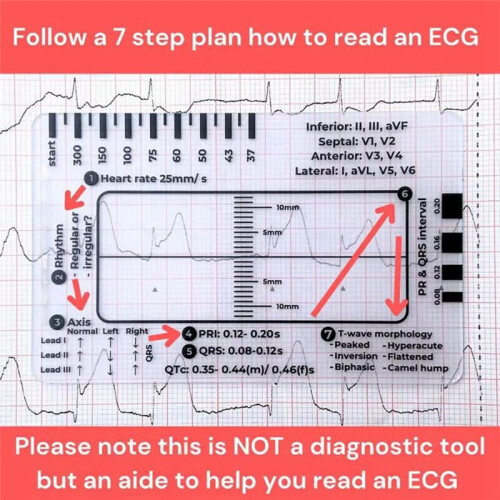 ECG 7 Step Ruler,ECG 7 Step Ruler for ECG/EKG Interpretation, ECG Reference Guide Ruler,EKG Calipers Measuring Tool 2