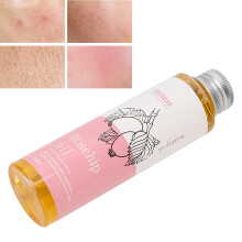 100ml Natürliches Hagebuttenöl für Hautreparatur, Aufhellung & Feuchtigkeitsversorgung