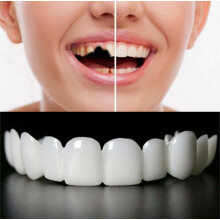 Fake Teeth Snap On Veneers and Bottom Set for Instant Smile Enhancement Adjustable Comfortable Fit