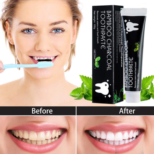 Charcoal Whitening Toothpaste with Mint for Stain Removal and Deep Cleaning, 2 Black Pack 2