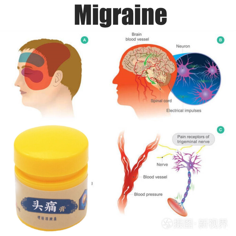 Herbal Headache Ointment 20g for Migraine Neuralgia Dizziness Relief