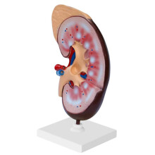 Kidney Anatomy Model with Detailed Internal Structure, Durable Resin, Numbered Markings for Teaching