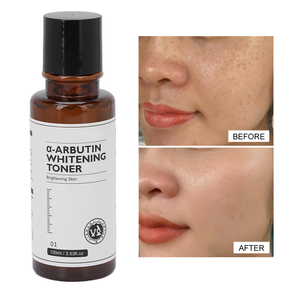 Arbutin Whitening Toner 100ml with Vitamin C, Deep Moisturizing & Brightening