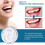 2 Pairs Adjustable Temporary Tooth Replacement Kit with Natural Tooth Appearance for Instant Smile 4