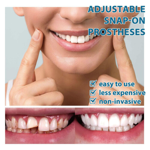 2 Pairs Adjustable Temporary Tooth Replacement Kit with Natural Tooth Appearance for Instant Smile 1