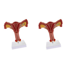 2X 1: 1 Menschliche Weibliche Gebärmutter Eierstock Eileiter Modell Anatomisches Menschliches Anatomiemodell Lehrmittel