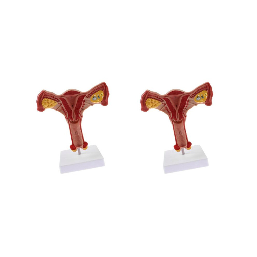 2X 1:1 Human Female Uterus Ovary Fallopian Tubes Model Anatomical Human Anatomy Model Teaching Tools