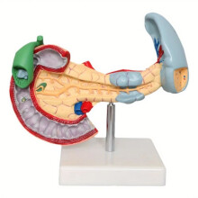 New Medical Anatomy Life Size Anatomical Pancreas Model Human Pancreas Model Duodenum Spleen Pathological Learning