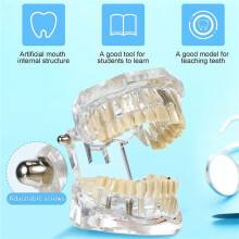 2X Modèle de Dents de Maladie Typodonts Dentaires Modèle D'Implant de Dents avec Dents Amovibles Démonstration de Dents Standard par le Dentiste