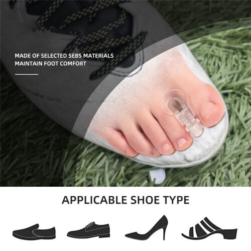10 Pack Toe Spacers Separators, Bunion Corrector Gel Orthotics for Bunion, Overlapping Toes,Hallux Valgus