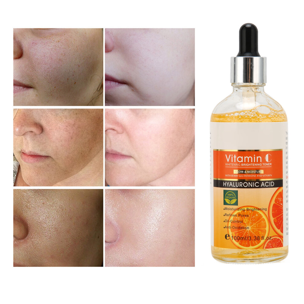 100ml VC Facial Serum Moisturizing Anti-Aging & Whitening Serum