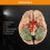 Life Size 8Part Human Brain Model with ColorCoded Anatomy and Display Base for Classroom Study 5