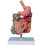 Human Colon Anatomy Model with Clear Lesion Visualization, Removable Digestive System Pathology Model 1