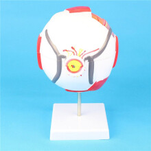 2X Modelo Anatômico Do Olho Modelo da Pálpebra Do Globo Ocular Desmontar Nervo Óptico Ampliado 6 Vezes para Ensino Especial Do Olho