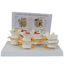 Four Stage Vertebrae Model, Human Anatomy and Physiology Educational Spine Model, Doctor'S Office Anatomy Model