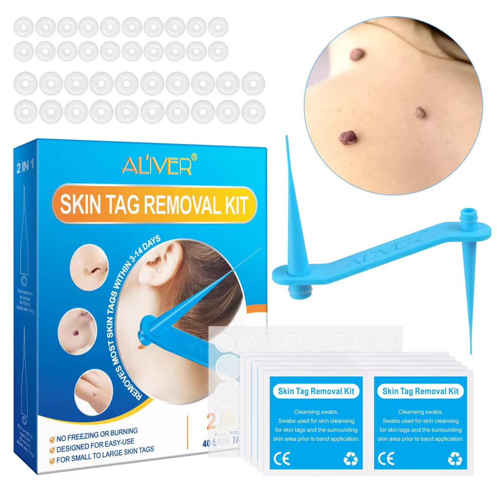 Al'iver Skin Tag Remover Kit Natural Painless 2 In 1 Bands Warts Mole Removal Treatment