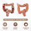 Teaching Model,Human Large Intestine Anatomy Model Visceral Lesion Model Human Digestive System Learning Model 2