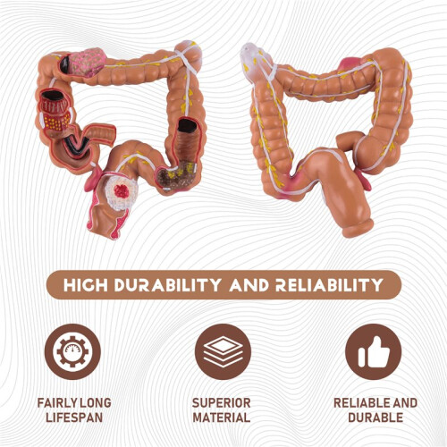 Teaching Model,Human Large Intestine Anatomy Model Visceral Lesion Model Human Digestive System Learning Model 1