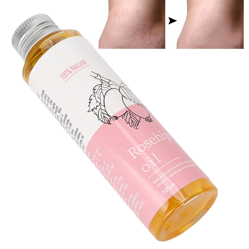 100ml Natural Rosehip Oil for Skin Care, Moisturizing & Scar Reduction