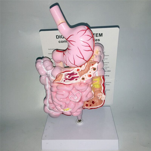Human Digestive System Model Stomach Anatomy Intestine Cecum Rectum Duodenum Human Internal Organs Structure Model 2