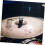 2Pcs Cymbal Stacker Attachment for Drum Set Dual Cymbal Mount Stable Secure Installation Versatile Hi Hat Setup 5