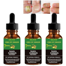 150ml Nails Care Repair Nail Fungal Anti-Fungus Onychomycosis-Removal Liquid Ginger Foot Antifungal Nail Treatments