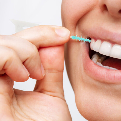 Gum Interdental Brushes for Braces 320 pcs 2