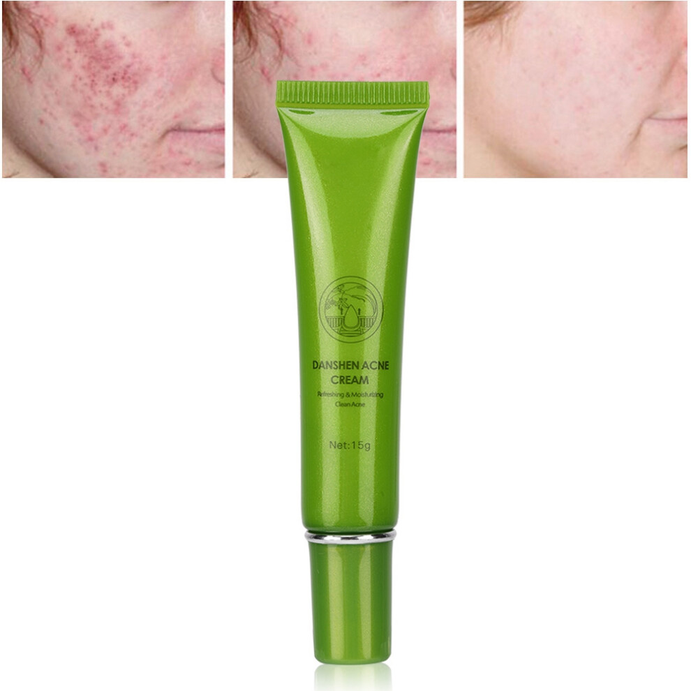 Cream Mabrem Acne Removal 15G - Clear Skin & Pimple Treatment