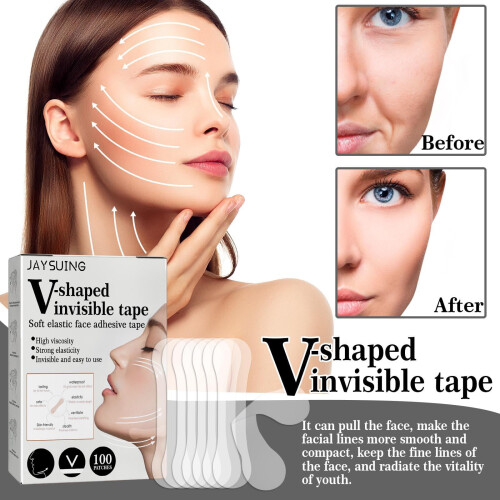 200 V Sticker Tape Tightening 2