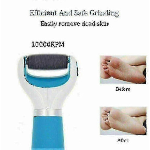 Electric Foot File Skin Remover 1