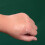 Healing Transparent Plaster Roll - Low Sensitivity 4