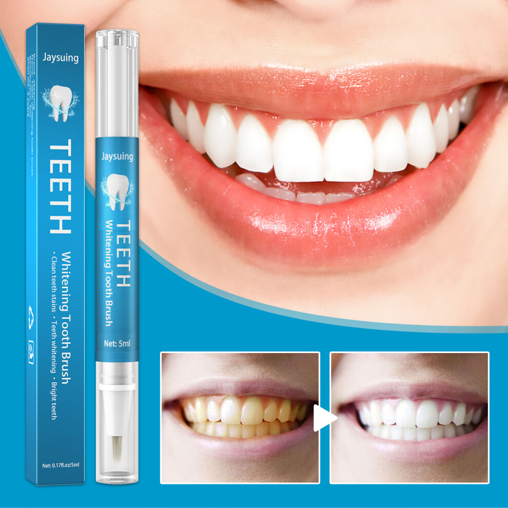 White Teeth Ning Pen Teeth Ning Stain Remover Brightening Pen