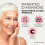 D Mannose 1000Mg Tablets Complex - 3-in-1 D-mannose Capsules with High-Strength 3