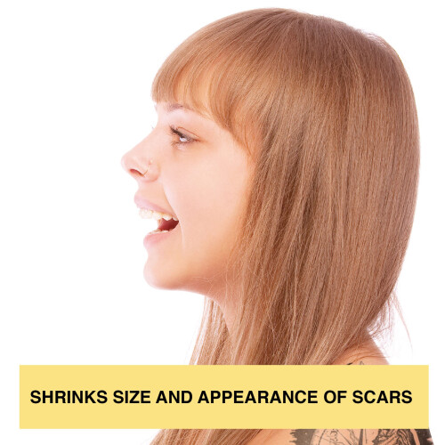 Base Labs Piercing Bump Treatment/Aftercare for Scar Removal | 2