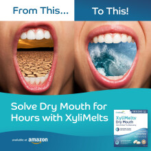 XyliMelts Dry Mouth Relief Discs Mild Mint (40 Count) – Xylitol Oral Adhering Tablets for Nighttime or Day Use, Long-Lasting Dry Mouth Relief & Sali