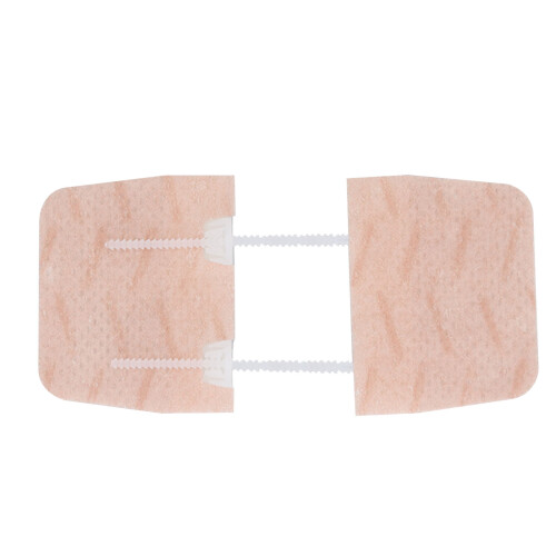 Wound Closure Patch with Zip Stitch, Self-Adhesive, 4x8cm 1