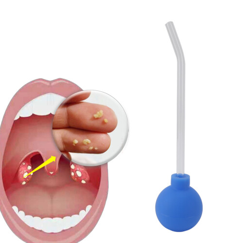 PVC Tonsil Stone Removal Tool Vacuum Suction Ball Blue 2